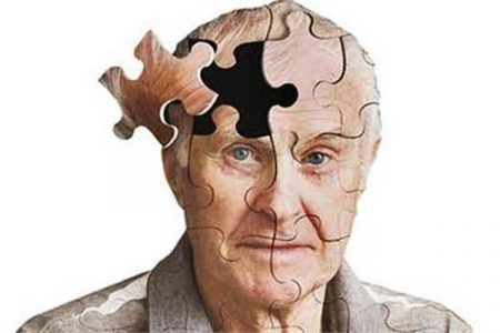 یک گام مثبت برای سالمندان / غربالگری اختلال حافظه کلید خورد